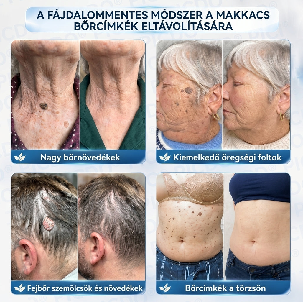 𝑽𝑳𝑺𝑽𝑳𝑺® 🎁 Első vásárlói ajándék! ✨ Második csomag -50% kedvezménnyel