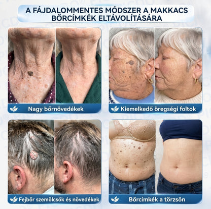 𝑽𝑳𝑺𝑽𝑳𝑺® 🎁 Első vásárlói ajándék! ✨ Második csomag -50% kedvezménnyel