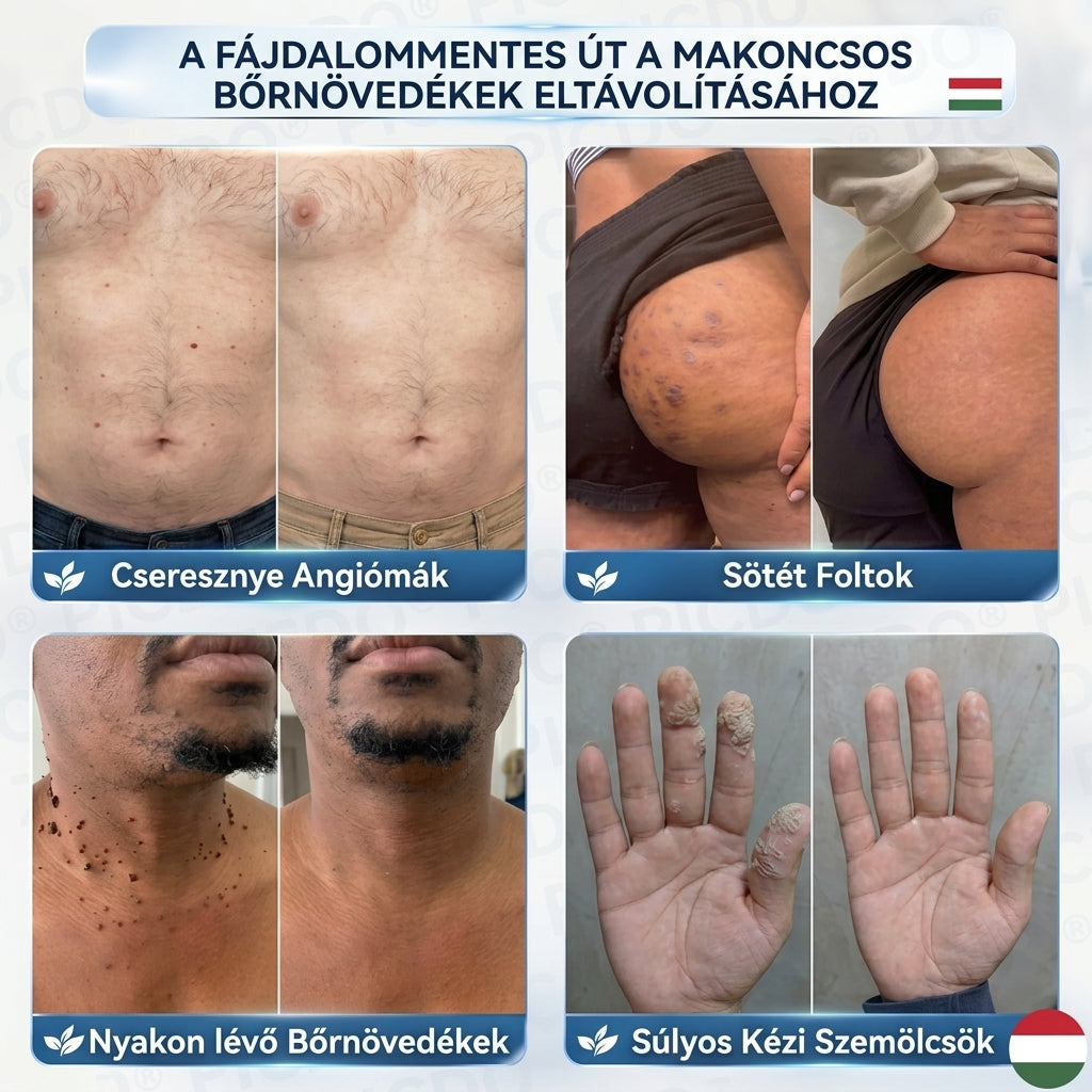 𝑽𝑳𝑺𝑽𝑳𝑺® 🎁 Első vásárlói ajándék! ✨ Második csomag -50% kedvezménnyel