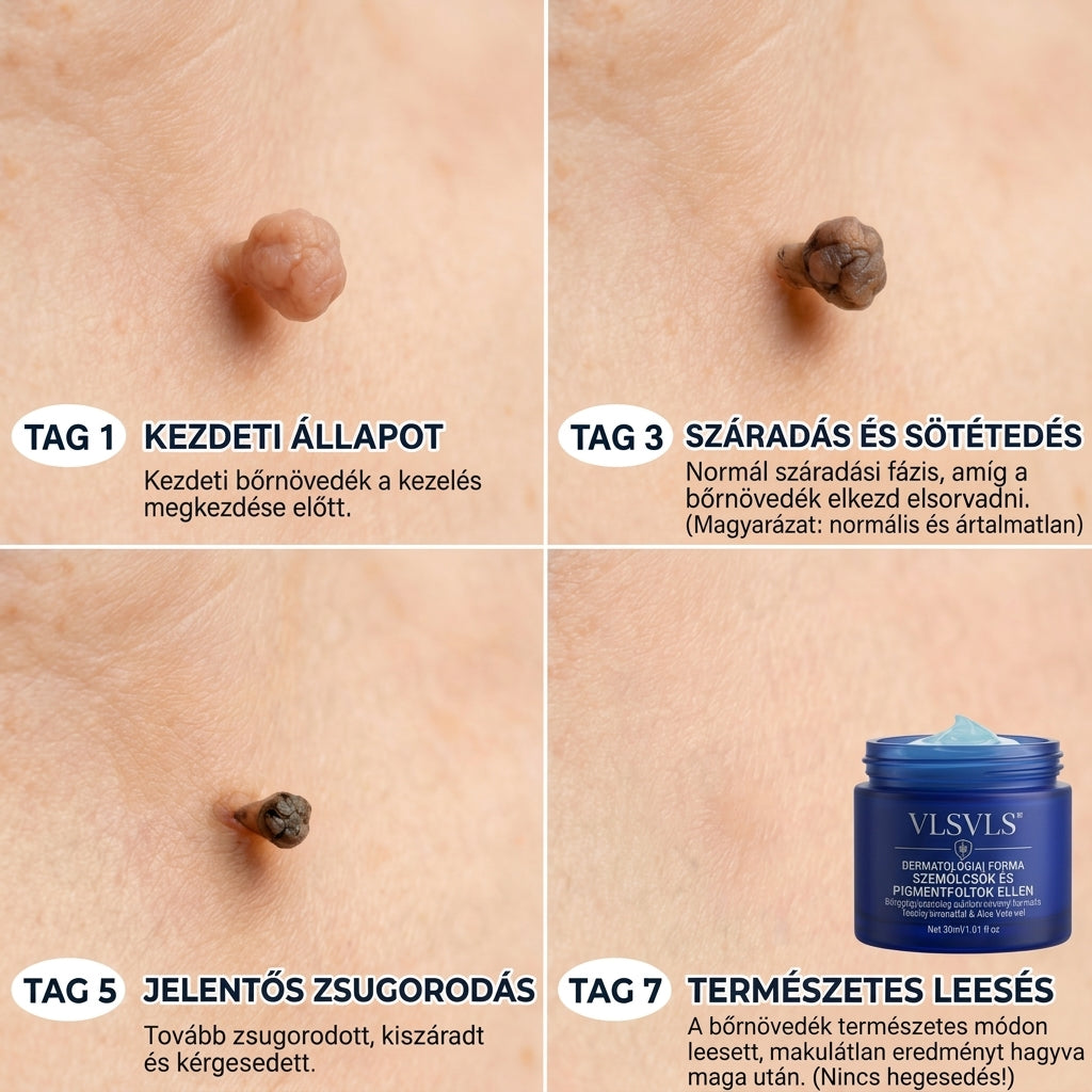 𝑽𝑳𝑺𝑽𝑳𝑺® 🎁 Első vásárlói ajándék! ✨ Második csomag -50% kedvezménnyel