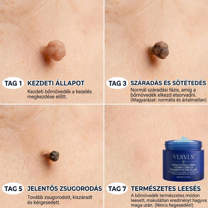 𝑽𝑳𝑺𝑽𝑳𝑺® 🎁 Első vásárlói ajándék! ✨ Második csomag -50% kedvezménnyel